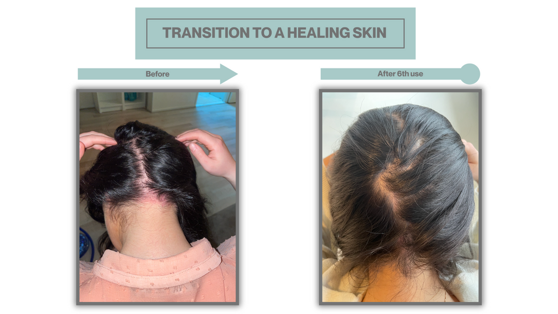 De wonderen van dode zee zout voor een stralende huid