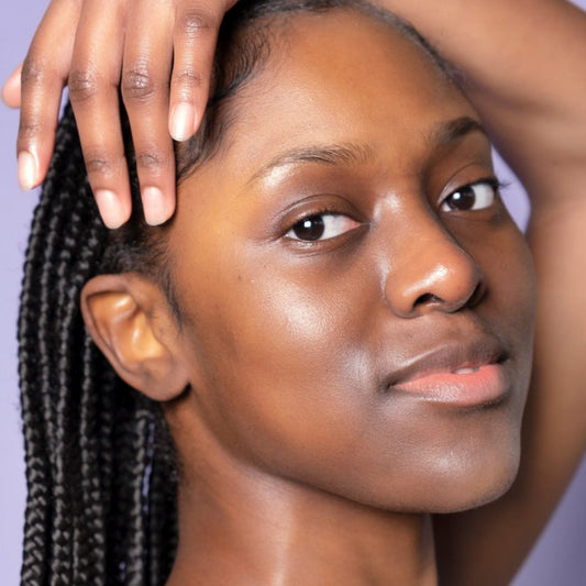 How to treat broken capillaries